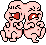 conjoined babies